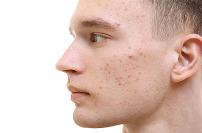 General Skin conditions